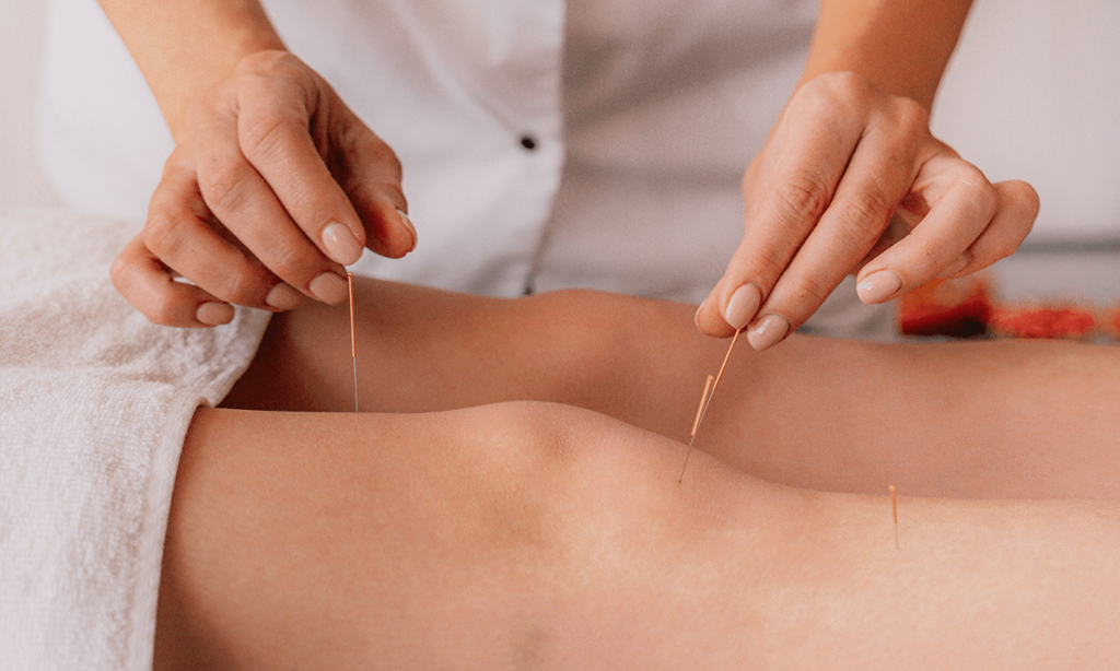 lalafuj acupuntura para dor