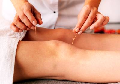 acupuntura tratamentos para melhorar a saúde e promover o bem estar
