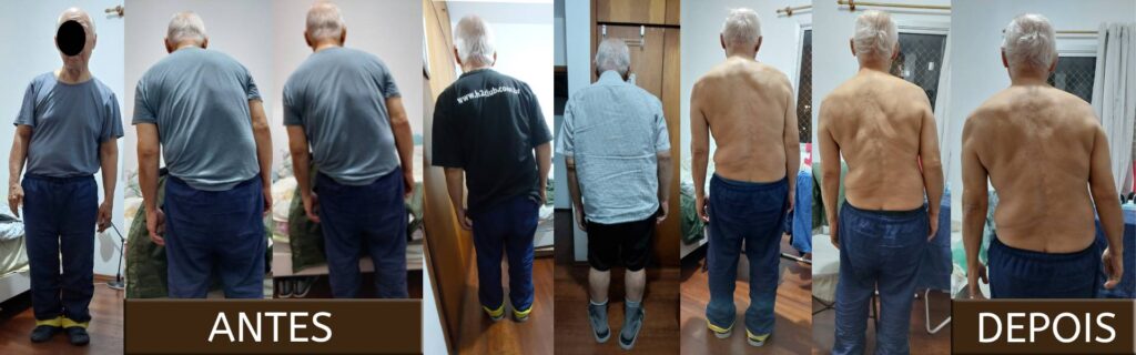 fisioterapia resultado do tratamento