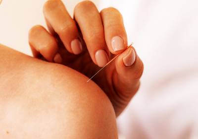 blog lalafuj acupuntura menopausa bem estar
