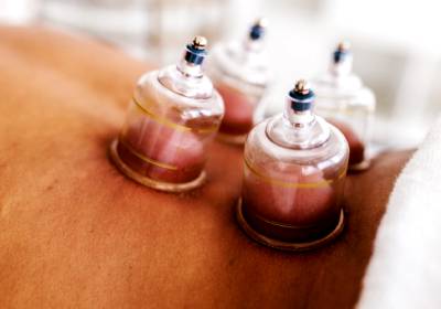 ventosa terapia terapias para melhorar a saúde e promover o bem estar